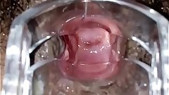 SLIM INDIAN BROWN GIRL CERVIX SPECULUM CHECK VAGINAL OPENING